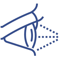 implantable collamer lens at K2 Vision